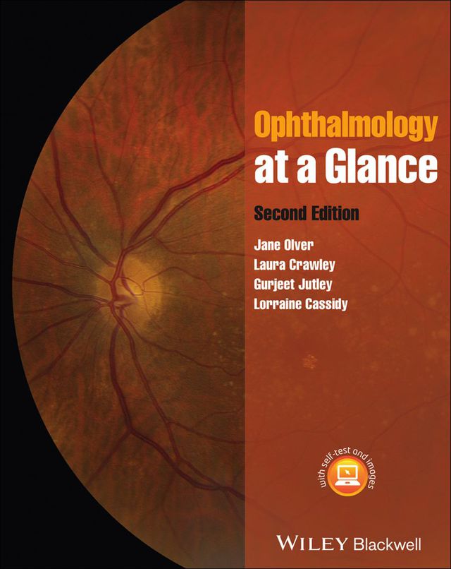 Ophthalmology at a Glance