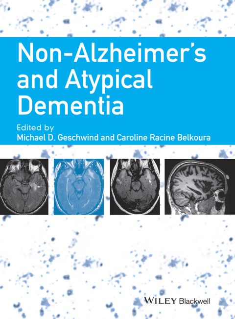 Cover image for book Non-Alzheimer's and Atypical Dementia