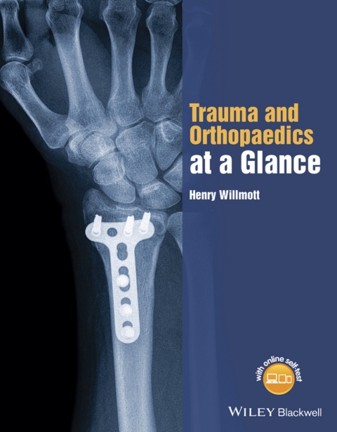 Cover image for book Trauma and Orthopaedics at a Glance