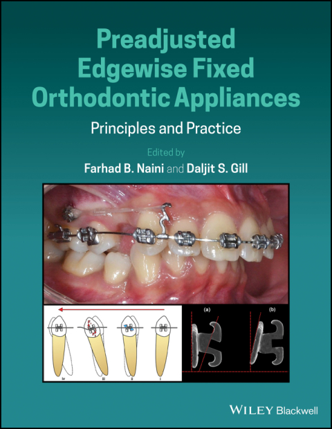 Cover image for book Preadjusted Edgewise Fixed Orthodontic Appliances