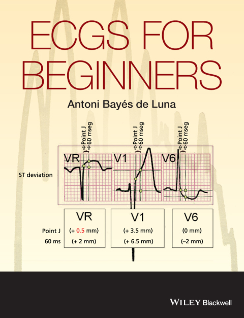 Cover image for book ECGs for Beginners