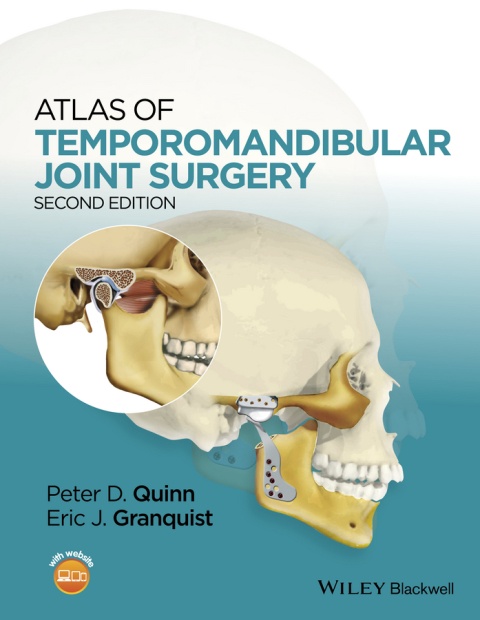 Cover image for book Atlas of Temporomandibular Joint Surgery