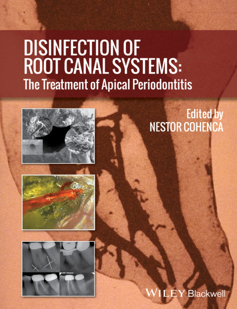 Cover image for book Disinfection of Root Canal Systems
