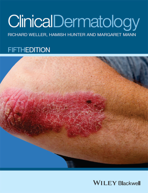 Clinical Dermatology, 5th Edition 
