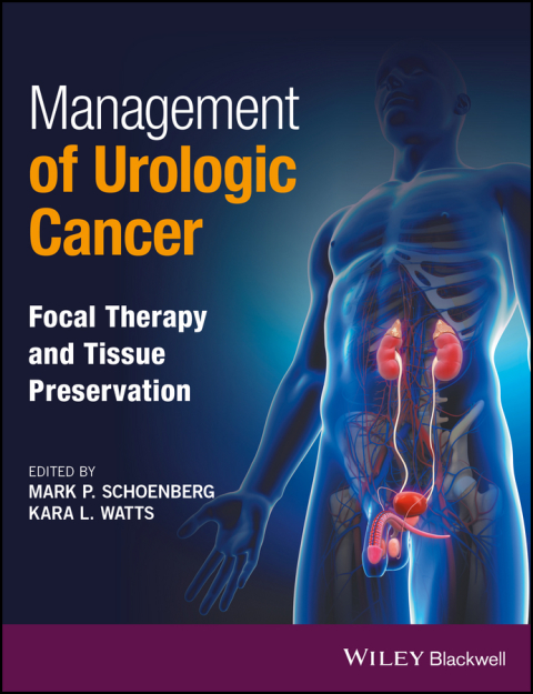Cover image for book Management of Urologic Cancer: Focal Therapy and Tissue Preservation
