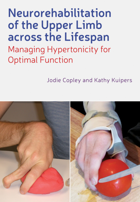 Cover image for book Neurorehabilitation of the Upper Limb Across the Lifespan