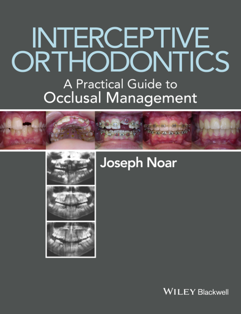 Cover image for book Interceptive Orthodontics
