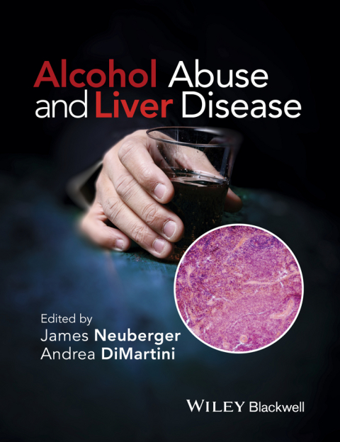 Cover image for book Alcohol Abuse and Liver Disease