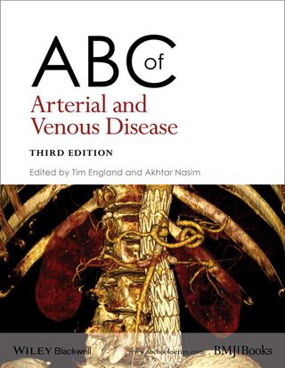Abc of Arterial and Venous Disease