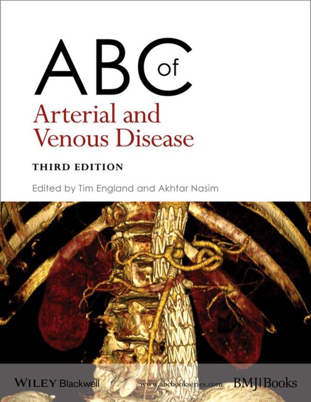 Abc of Arterial and Venous Disease