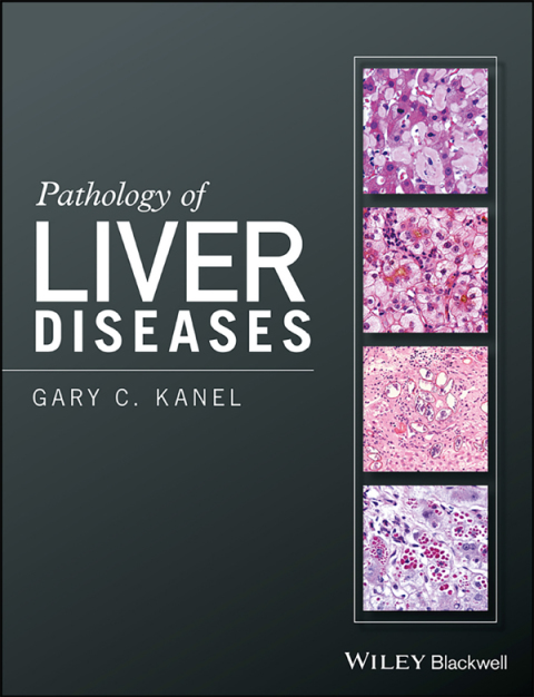 Cover image for book Pathology of Liver Diseases