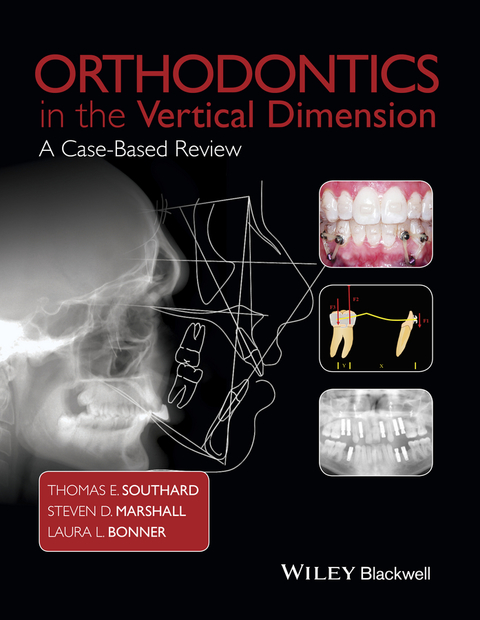 Cover image for book Orthodontics in the Vertical Dimension: A Case-Based Review