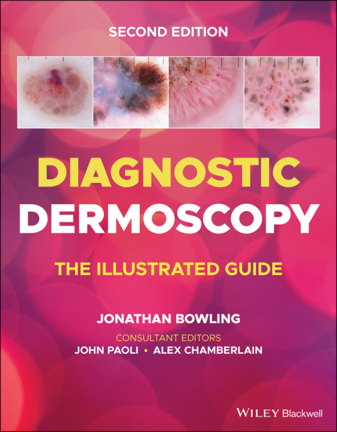 Cover image for book Diagnostic Dermoscopy