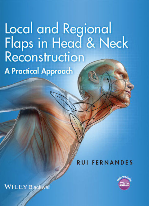 Cover image for book Local and Regional Flaps in Head and Neck Reconstruction