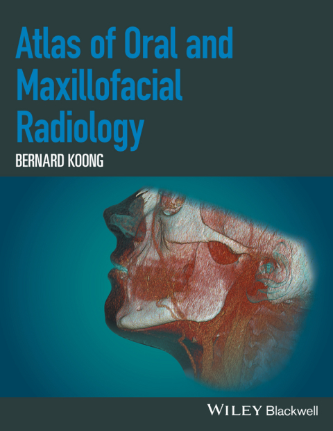 Cover image for book Atlas of Oral and Maxillofacial Radiology