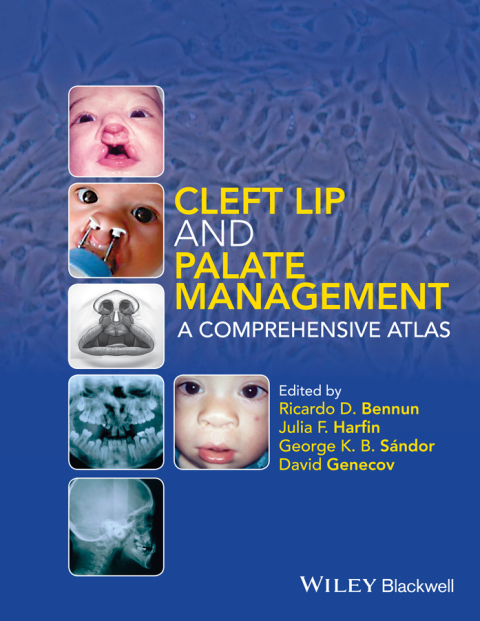 Cover image for book Cleft Lip and Palate Management: A Comprehensive Atlas