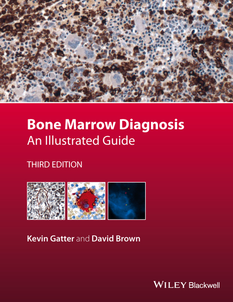 Cover image for book Bone Marrow Diagnosis: An Illustrated Guide
