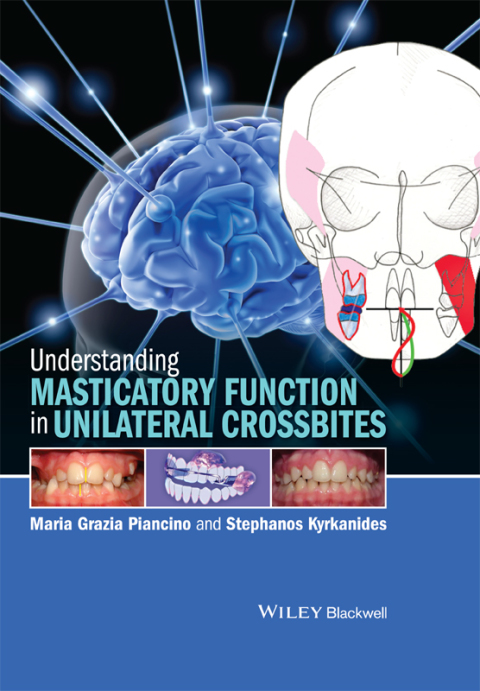 Cover image for book Understanding Masticatory Function in Unilateral Crossbites