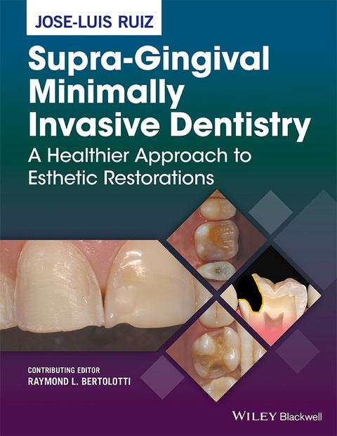Cover image for book Supra-Gingival Minimally Invasive Dentistry: A Healthier Approach to Esthetic Restorations