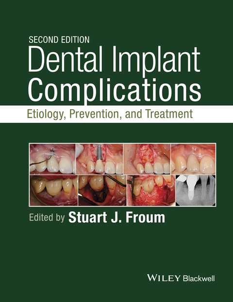 Cover image for book Dental Implant Complications: Etiology, Prevention, and Treatment