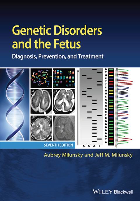 Genetic Disorders and the Fetus: Diagnosis, Prevention, and Treatment 