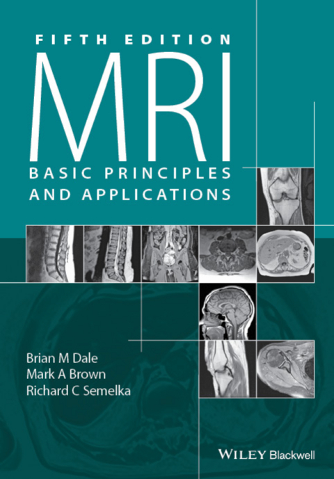 MRI: Basic Principles and Applications 