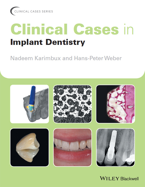 Cover image for book Clinical Cases in Implant Dentistry