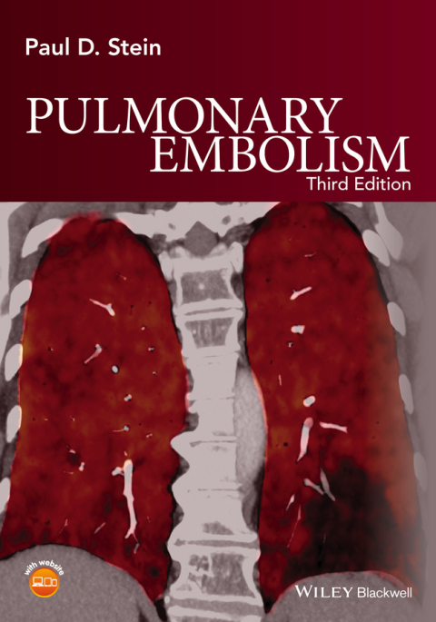 Cover image for book Pulmonary Embolism