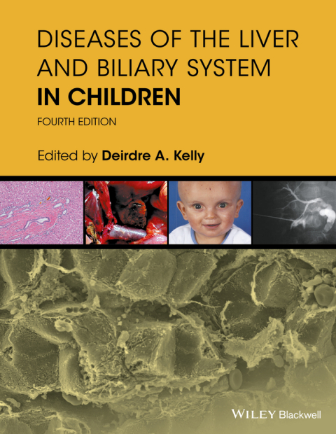 Diseases of the Liver and Biliary System in Children 