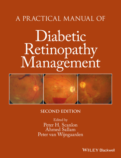 Cover image for book A Practical Manual of Diabetic Retinopathy Management