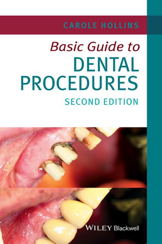 Basic Guide to Dental Procedures