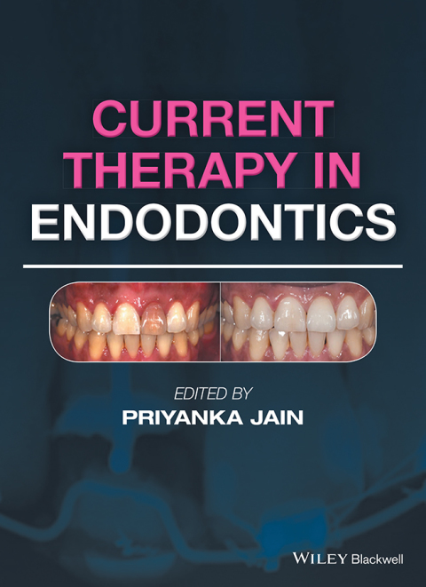 Cover image for book Current Therapy in Endodontics