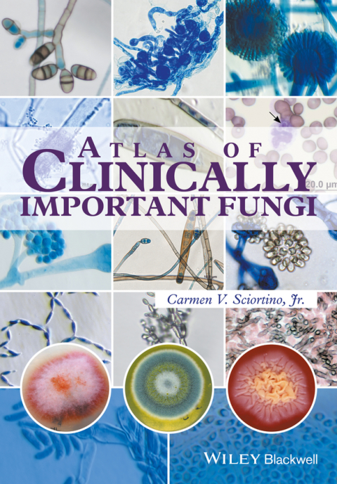 Cover image for book Atlas of Clinically Important Fungi