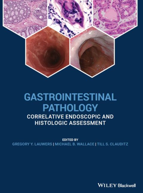Cover image for book Gastrointestinal Pathology