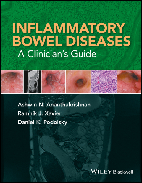 Inflammatory Bowel Diseases: A Clinician's Guide 