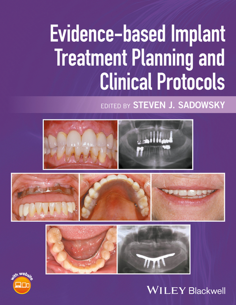Cover image for book Evidence-based Implant Treatment Planning and Clinical Protocols