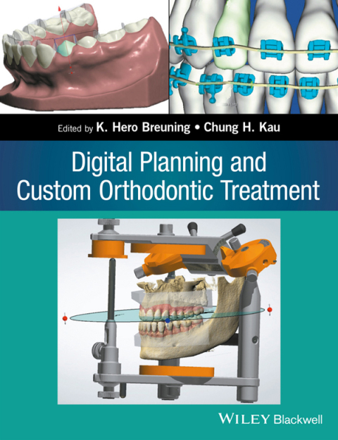 Cover image for book Digital Planning and Custom Orthodontic Treatment