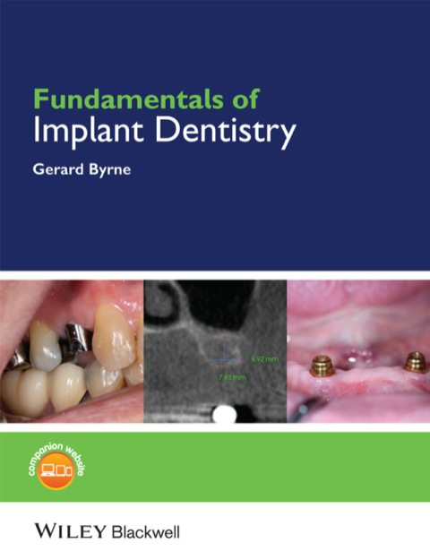 Cover image for book Fundamentals of Implant Dentistry