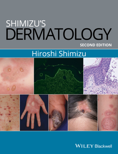 Cover image for book Shimizu's Dermatology