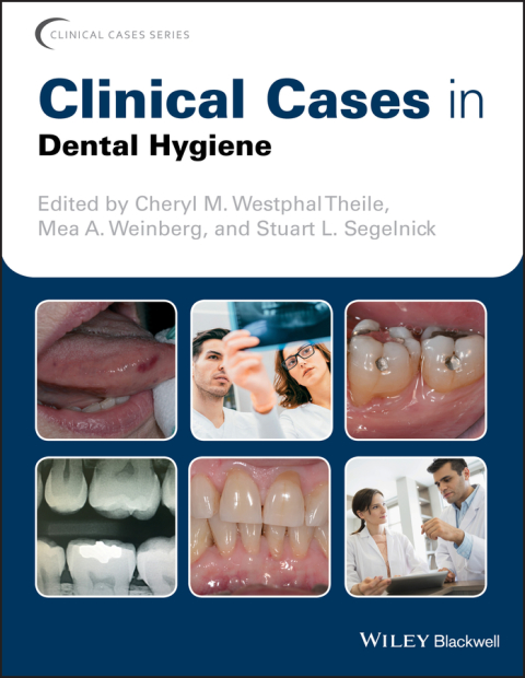 Cover image for book Clinical Cases in Dental Hygiene
