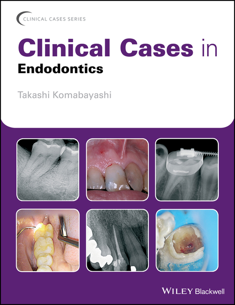 Cover image for book Clinical Cases in Endodontics