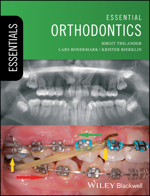 Cover image for book Essential Orthodontics