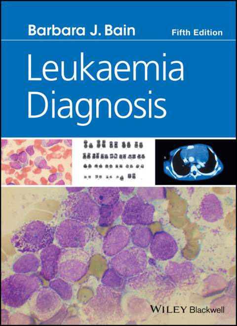 Leukaemia Diagnosis 