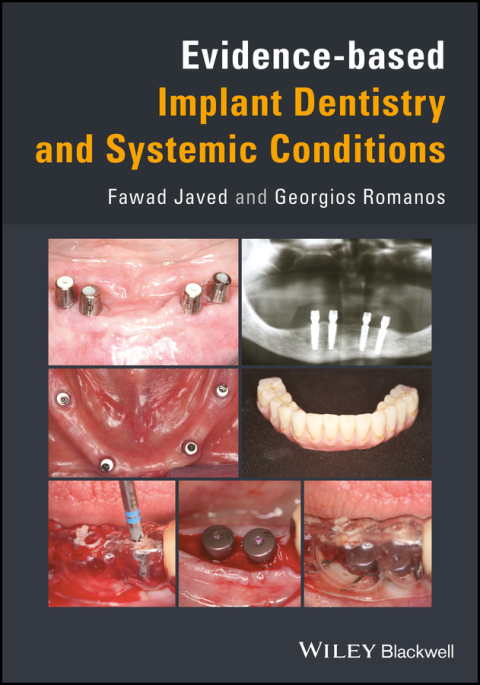 Cover image for book Evidence-based Implant Dentistry and Systemic Conditions