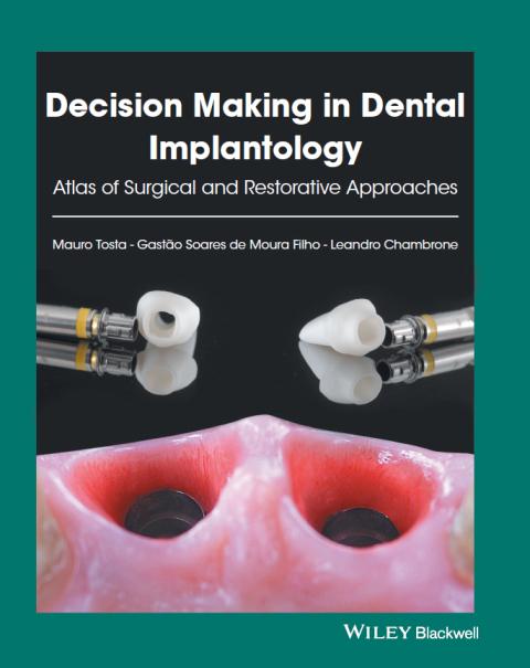 Cover image for book Decision Making in Dental Implantology: Atlas of Surgical and Restorative Approaches