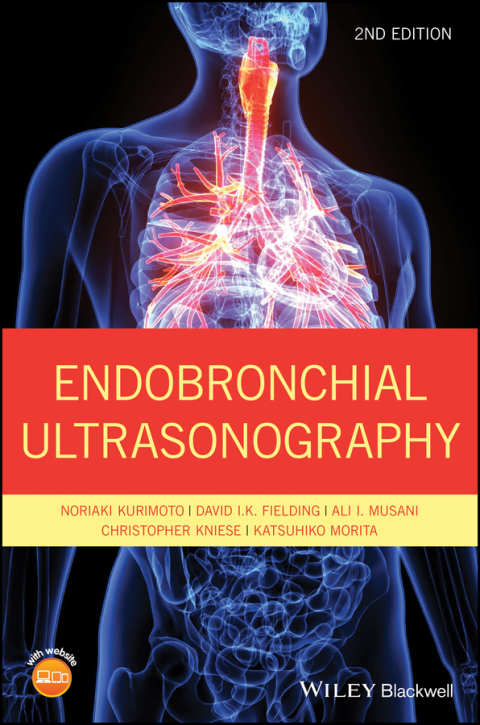 Cover image for book Endobronchial Ultrasonography