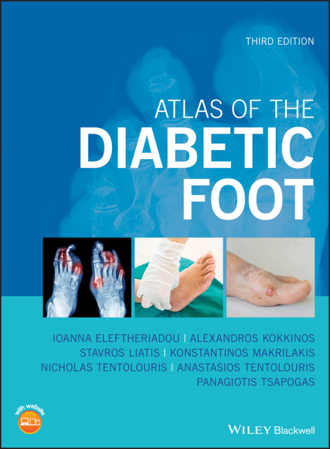 Cover image for book Atlas of the Diabetic Foot