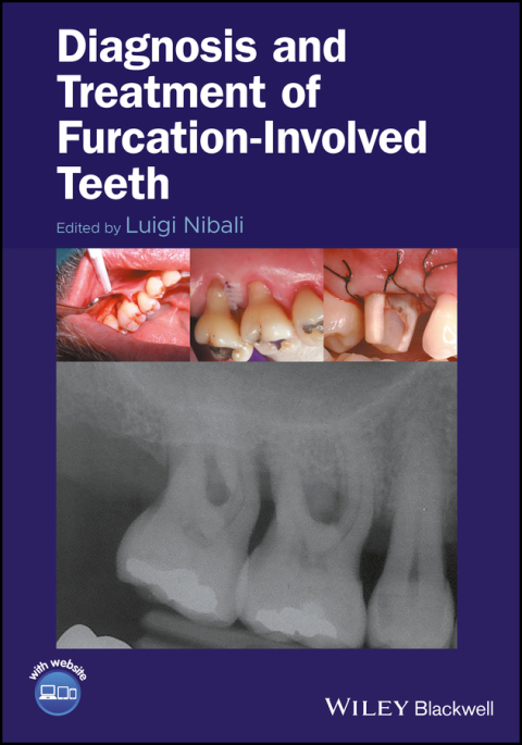 Cover image for book Diagnosis and Treatment of Furcation-Involved Teeth
