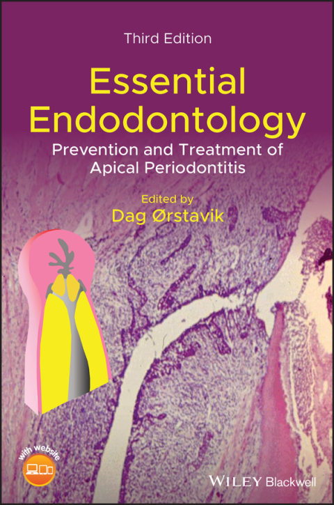 Cover image for book Essential Endodontology