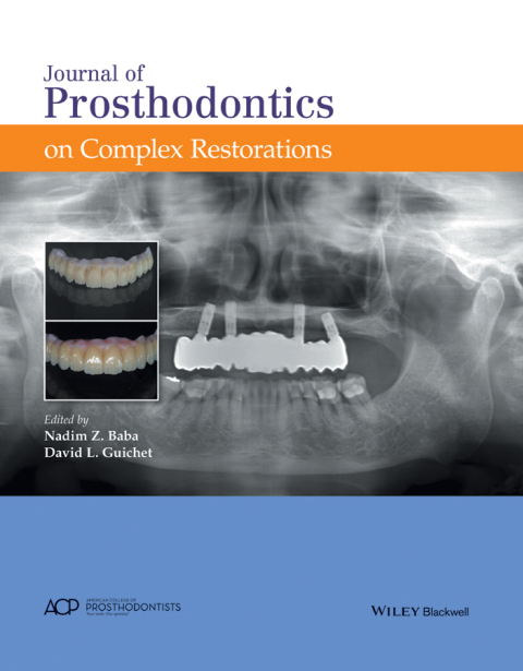 Cover image for book Journal of Prosthodontics on Complex Restorations